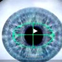 лазерная коррекция астигматизма лазерная коррекция астигматизма в клинике Коновалова