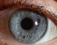 как вылечить близорукость раз и навсегда