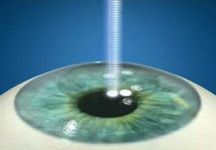 ласик москва