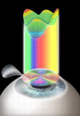 ласик последствия