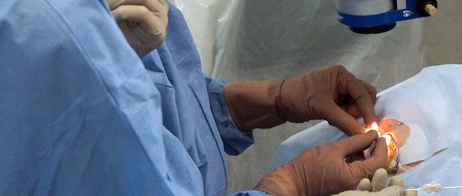 Ограничения после операции по удалению катаракты