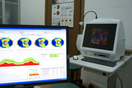 Оптическая когерентная томография
