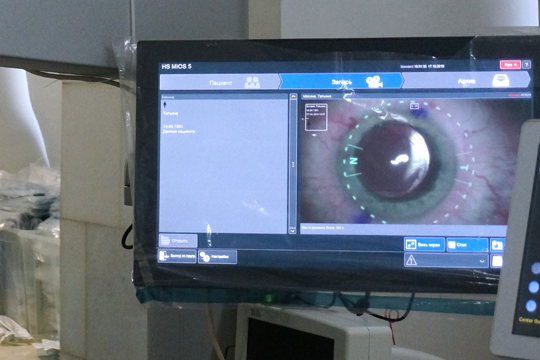 Катаракта хрусталика