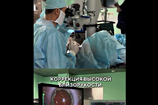 Коррекция высокой близорукости