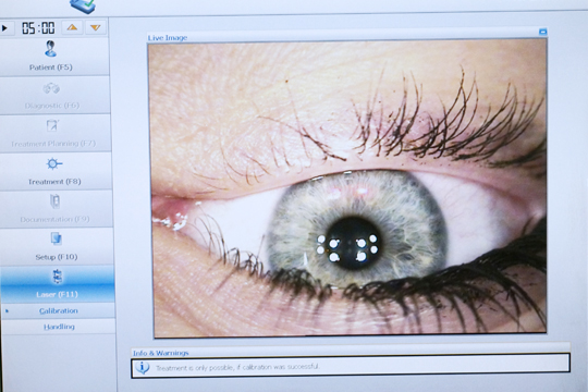 Коррекция зрения эксимер лазером: истоки и современность