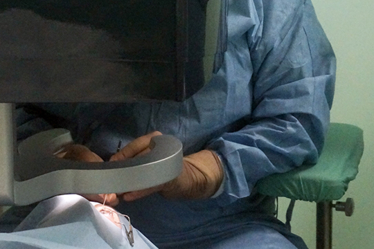 Виды операций по лазерной коррекция зрения