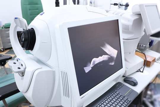 Дегенерация сетчатки глаза