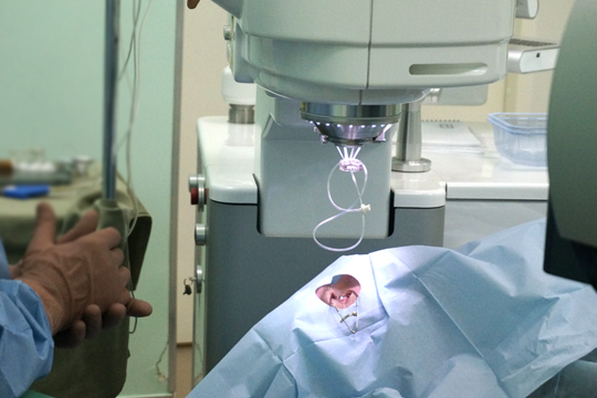 Лазик: цены снижаются