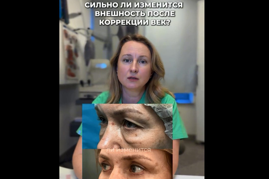 Сильно ли изменится внешность после коррекции век?
