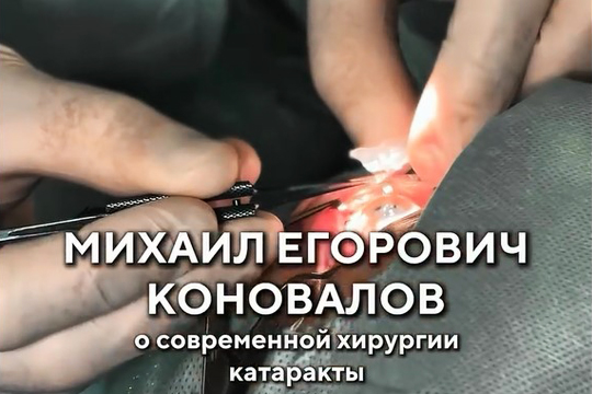 О современной хирургии катаракты