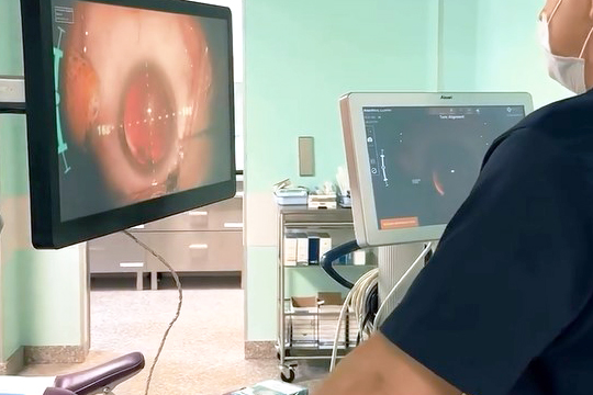 Какие проблемы решает хирургия катаракты