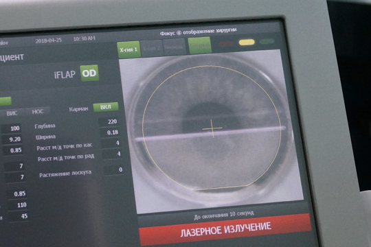 Кому поможет эксимерлазерная коррекция зрения?