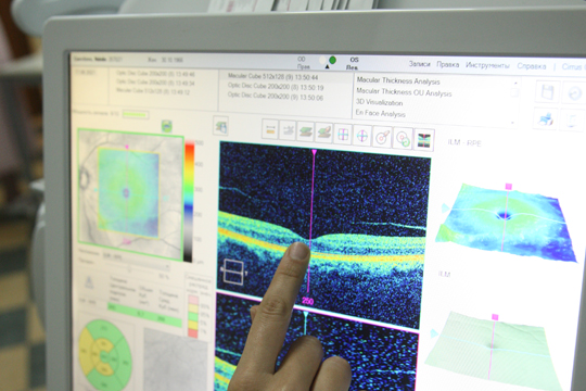 Лечение дистрофии сетчатки глаза с использованием лазера