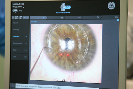 Разновидности операций при миопии