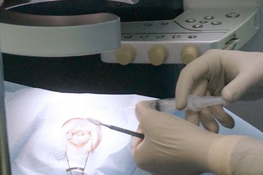 Методы лазерной коррекции зрения