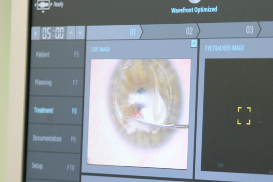 Как улучшить зрение при близорукости – актуальная проблема