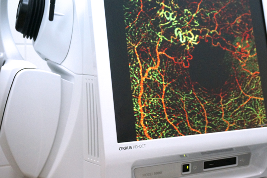 Заболевания сетчатки: макулярная дегенерация, ретинопатия, периферическая дистрофия