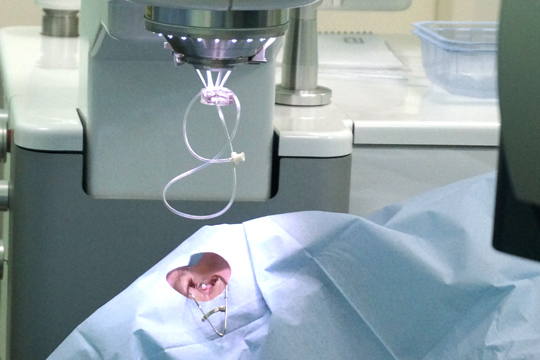 Ласик - видео для тех, кто интересуется процессом