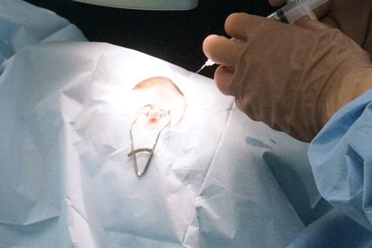 Видео-материалы по лазерной коррекции зрения