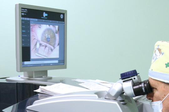 Этапы операции по лазерной коррекции Ласик