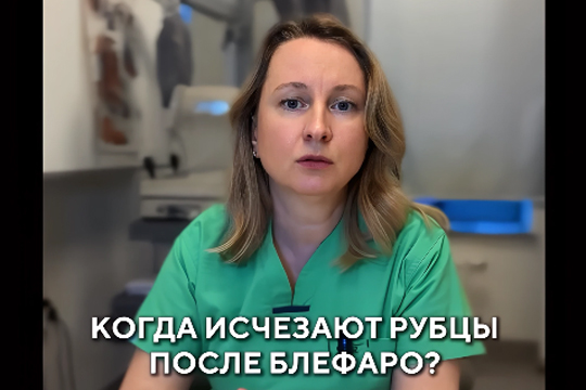 Рубцы после коррекции век