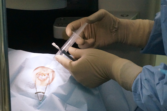 Эксимер лазерная коррекция как эффективный метод в офтальмологии