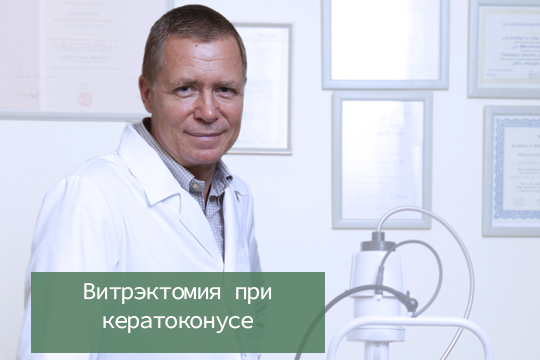 Витрэктомия при кератоконусе