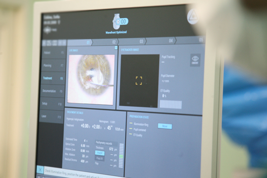 Радикальный метод лечения дальнозоркости