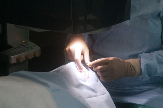 Противопоказания для операции Лазик