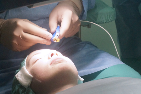 Высокая близорукость: варианты операций