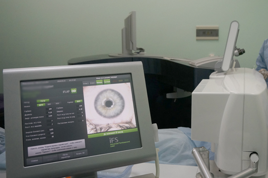 Как быть, чтобы последствия операции Ласик были только положительными?