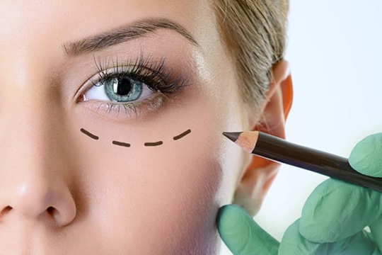 Операции на веках. Блефаропластика.