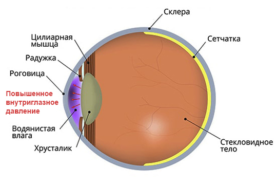 Течение глаукомы и симптомы этого заболевания