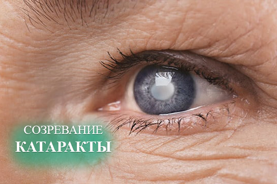 Созревание катаракты