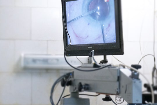 Катаракта: симптомы, лечение и современные методы операции