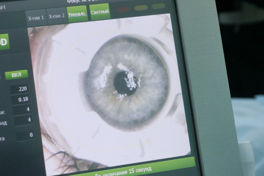 Лазерное лечение зрения - борьба с глаукомой, катарактой и другими заболеваниями