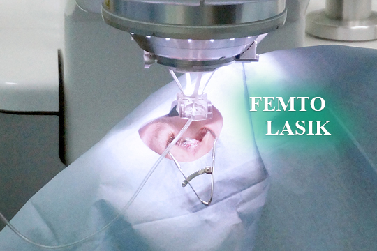 Как проходит операция по лазерной коррекции зрения Фемто Ласик