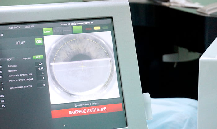 вероятность осложнений после Ласик