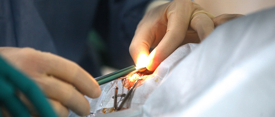 Лечение катаракты глаза Лечение катаракты глаза