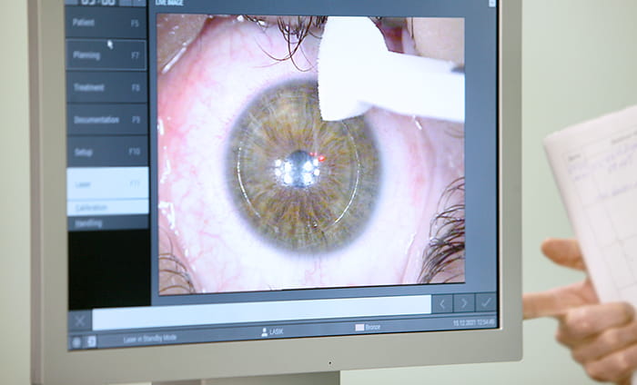 операция ласик отзывы