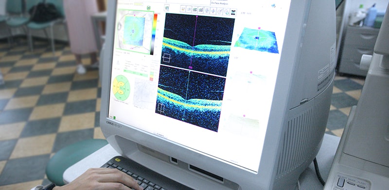 ВМД обычно прогрессирует незаметно, поэтому регулярные осмотры имеют важное значение