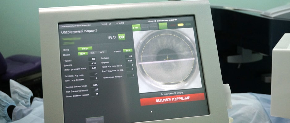 Аппарат справляется с широким спектром степеней рефракционных нарушений (лечение дальнозоркости, близорукости, астигматизма, в том числе их осложненных форм) lazernaya_korrekciya_zreniya_stoimost.jpg