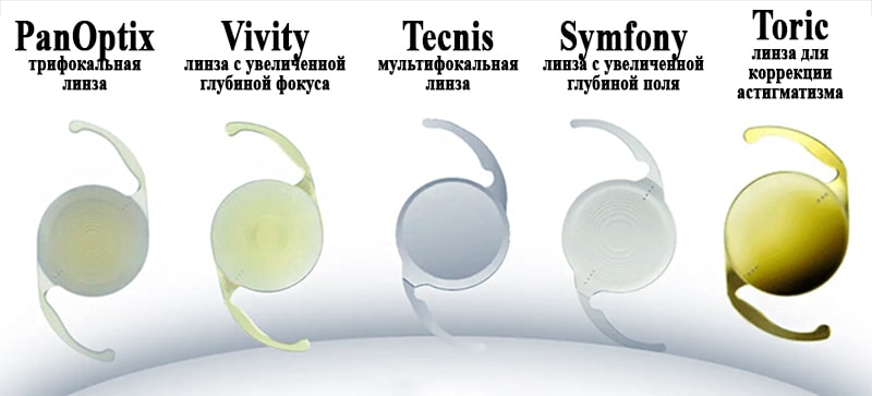 Отдельно хрусталика на близорукость, на дальнозоркость нет, все решается путем расчёта оптической силы искусственного хрусталика. То сеть одна модель хрусталика имеет разную диоптрийность.