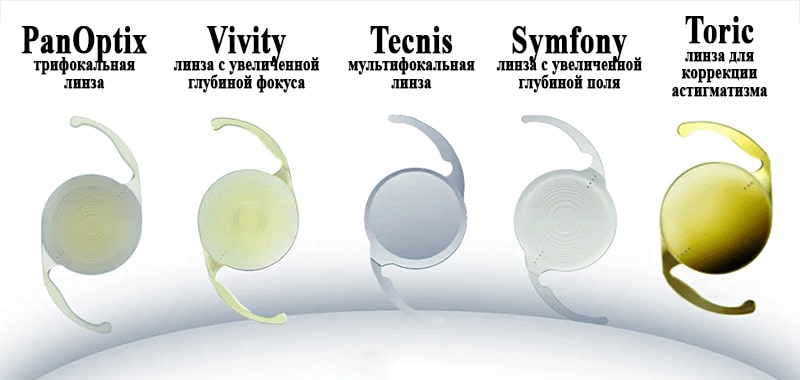Основная задача ИОЛ: обеспечить нужную послеоперационную рефракцию, необходимой пациенту для комфортной жизни.