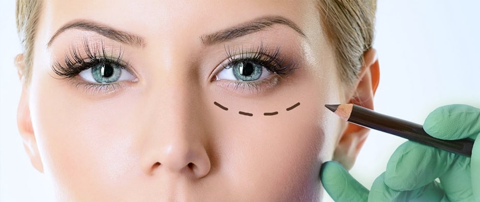 surgery-of-the-eyelids-blepharoplasty.jpg surgery-of-the-eyelids-blepharoplasty.jpg