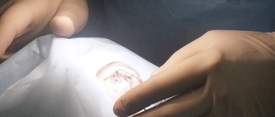 В целом, метод ЛАСИК является одним из самых распространенных на сегодняшний день. operaciya_super_lasik.jpg