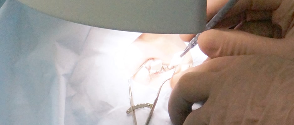 стоимость Фемто Ласик и Супер Ласик превышает намного стоимость стандартной операции ЛАСИК. skolko_stoit_lazernaya_korrekciya.jpg