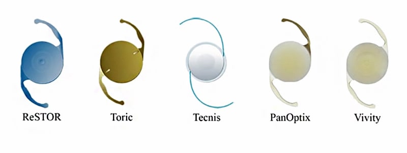 Имплантация ИОЛ при пресбиопии Имплантация ИОЛ