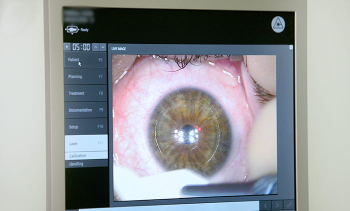 операция – близорукость останется в прошлом