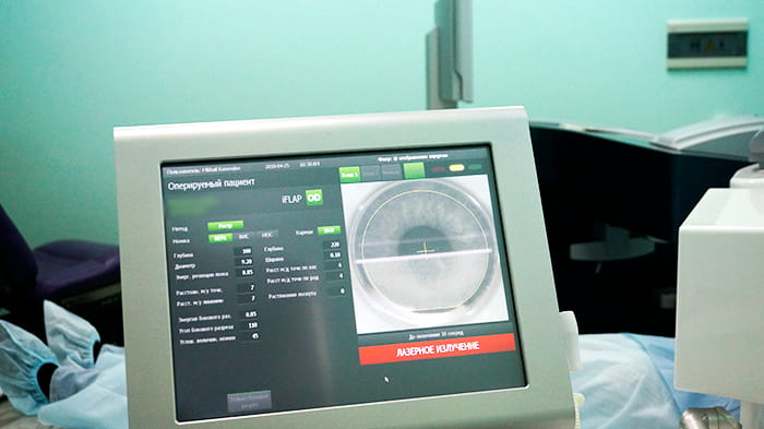 ласик последствия